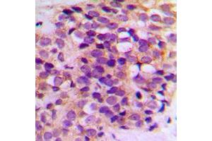 Immunohistochemistry (IHC) image for anti-B-Cell CLL/lymphoma 2 (BCL2) (Center) antibody (ABIN7300414)