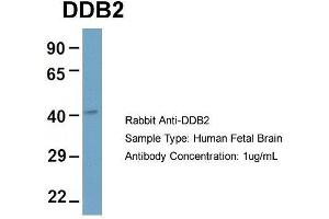 Host: Rabbit  Target Name: DDB2  Sample Tissue: Human Fetal Brain  Antibody Dilution: 1. (DDB2 抗体  (C-Term))