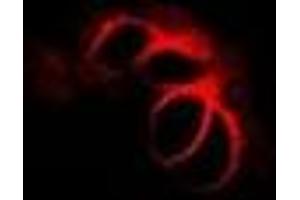 Immunofluorescent analysis of CHMP2B staining in MCF7 cells. (CHMP2B 抗体)