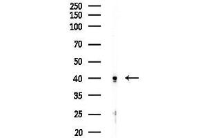 Western blot analysis of lysates from EC304 cells, using USP3 Antibody at 1/1000 dilution.