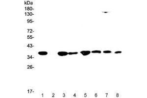 Western blot testing of human 1) HeLa, 2) placenta, 3) SW620, 4) PANC-1, 5) HepG2, 6) A549, 7) rat RH35 and 8) mouse HEPA1-6 lysate with SMN1/2 antibody at 0. (SMN1 / SMN2 抗体)
