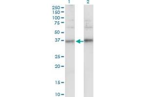 Western Blot analysis of TSPAN32 expression in transfected 293T cell line by TSPAN32 monoclonal antibody (M02), clone 2B4. (TSPAN32 抗体  (AA 194-290))