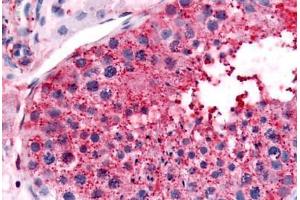 Human Testis (formalin-fixed, paraffin-embedded) stained with UCHL3 antibody ABIN213583 at 10 ug/ml followed by biotinylated goat anti-rabbit IgG secondary antibody ABIN481713, alkaline phosphatase-streptavidin and chromogen. (UCHL3 抗体  (Internal Region))