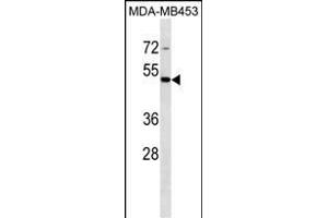 STAC Antibody (C-term) (ABIN1537013 and ABIN2849881) western blot analysis in MDA-M cell line lysates (35 μg/lane). (STAC 抗体  (C-Term))
