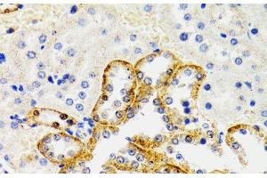 Immunohistochemistry of paraffin-embedded Rat kidney using SH2B1 Polyclonal Antibody at dilution of 1:100 (40x lens). (SH2B1 抗体)
