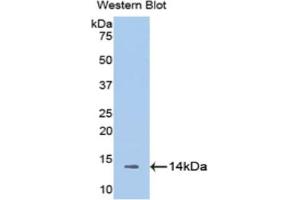 Western blot analysis of the recombinant protein. (Melatonin Receptor 1A 抗体  (AA 216-257))