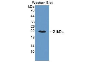 Figure. (ALDH2 抗体  (AA 59-150))