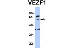 Western Blotting (WB) image for anti-Vascular Endothelial Zinc Finger 1 (VEZF1) (Middle Region) antibody (ABIN2776482)