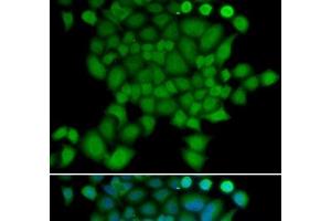 Immunofluorescence analysis of U2OS cells using NEDD9 Polyclonal Antibody