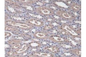 Detection of RDX in Human Kidney Tissue using Polyclonal Antibody to Radixin (RDX) (Radixin 抗体  (AA 5-295))