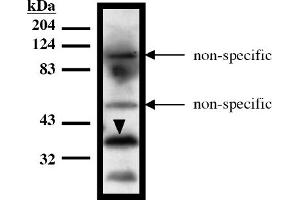 Western Blotting (WB) image for anti-HIR Histone Cell Cycle Regulation Defective Homolog A (HIRA) (AA 1-200), (N-Term) antibody (ABIN264454) (HIRA 抗体  (N-Term))