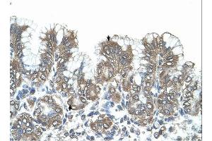 SNF1LK antibody was used for immunohistochemistry at a concentration of 4-8 ug/ml. (SIK1 抗体  (N-Term))