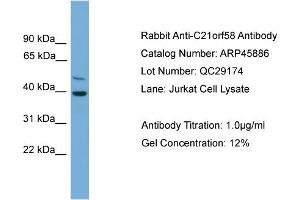 WB Suggested Anti-C21orf58  Antibody Titration: 0. (C21orf58 抗体  (N-Term))
