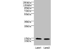 Western blot All lanes: FAM136A antibody at 8 μg/mL Lane 1: Hela whole cell lysate Lane 2: Caco-2 whole cell lysate Secondary Goat polyclonal to rabbit IgG at 1/10000 dilution Predicted band size: 16 kDa Observed band size: 16 kDa (FAM136A 抗体  (AA 2-138))