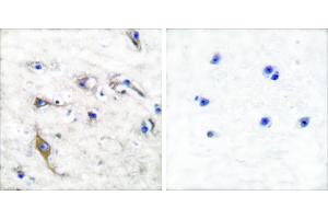 Peptide - +Immunohistochemical analysis of paraffin-embedded human brain tissue using JM4 antibody (#C0238). (PRAF2 抗体)