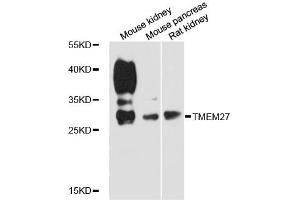 Western blot analysis of extracts of various cell lines, using TMEM27 antibody (ABIN6292811) at 1:3000 dilution. (TMEM27 抗体)