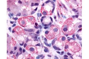 Anti-HRH2 / Histamine H2 Receptor antibody IHC of human stomach, parietal cells. (HRH2 抗体  (Cytoplasmic Domain))