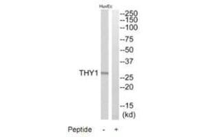 Western blot analysis of extracts from HuvEc cells, using THY1 antibody. (CD90 抗体)