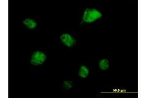 Immunofluorescence of purified MaxPab antibody to RBM6 on HeLa cell. (RBM6 抗体  (AA 1-601))