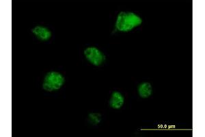 Immunofluorescence of purified MaxPab antibody to RBM6 on HeLa cell. (RBM6 抗体  (AA 1-601))