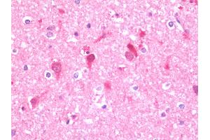 Anti-UFD2A / UBE4B antibody IHC staining of human brain, cortex. (UBE4B 抗体  (AA 869-1179))