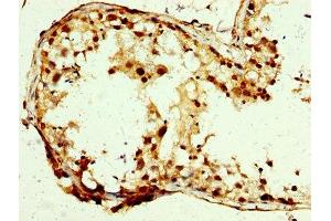 IHC image of ABIN7146356 diluted at 1:250 and staining in paraffin-embedded human testis tissue performed on a Leica BondTM system. (SLC25A24 抗体  (AA 1-197))