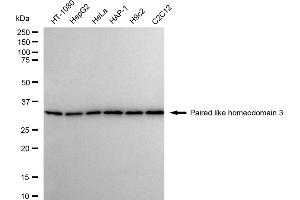 anti-Pituitary Homeobox 3 (PITX3) antibody