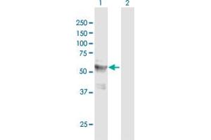 Western Blot analysis of LPCAT4 expression in transfected 293T cell line ( H00254531-T01 ) by LPCAT4 MaxPab polyclonal antibody. (LPCAT4 抗体  (AA 1-524))