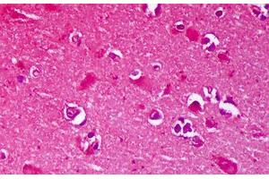 Anti-GRIN2B / NMDAR2B antibody IHC staining of human brain, cortex neurons.