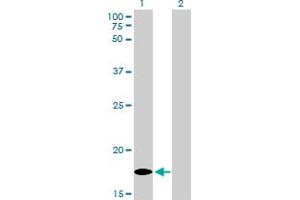 Western Blot analysis of MCFD2 expression in transfected 293T cell line by MCFD2 monoclonal antibody (M01), clone 3A5-G4. (MCFD2 抗体  (AA 1-146))