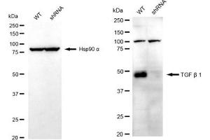 Western blotting analysis using TGF beta 1 antibody (ABIN7800605).