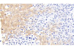 Detection of CALPRO in Human Tonsil Tissue using Polyclonal Antibody to Calprotectin (CALPRO) (S100A8/A9 Complex (Calprotectin) 抗体  (AA 1-114))