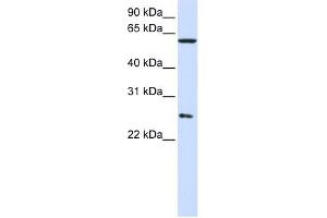 CCT7 antibody used at 1 ug/ml to detect target protein. (CCT7 抗体)