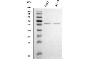 Western blot analysis of KLF5 using anti-KLF5 antibody (ABIN3044106).