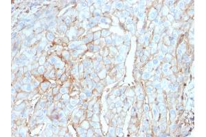Immunohistochemistry (IHC) image for anti-CD274 (PD-L1) (AA 39-191) antibody (ABIN6939571)