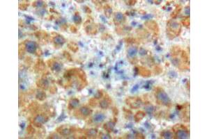 Used in DAB staining on fromalin fixed paraffin- embedded Kidney tissue (Angiostatin 抗体  (AA 98-436))