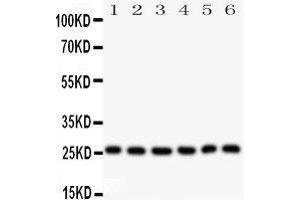 Observed bind size: 26KD (Galectin 3 抗体  (AA 139-250))
