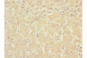 Immunohistochemistry of paraffin-embedded human liver tissue using ABIN7168232 at dilution of 1:100