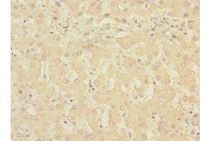 Immunohistochemistry of paraffin-embedded human liver tissue using ABIN7168232 at dilution of 1:100 (RCHY1 抗体  (AA 1-261))