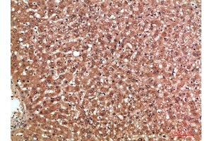 Immunohistochemical analysis of paraffin-embedded human-liver, antibody was diluted at 1:200 (MBL2 抗体  (AA 21-70))