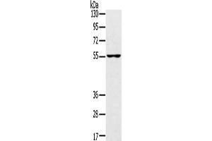 Western Blotting (WB) image for anti-Upstream Binding Protein 1 (LBP-1a) (UBP1) antibody (ABIN2433292) (UBP1 抗体)