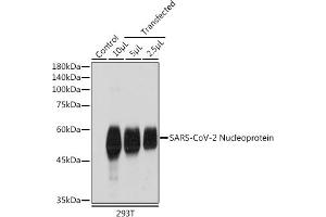 Western blot analysis of extracts of normal 293T cells and 293T transfected with Nucleoprotein,using SARS-CoV-2 Nucleoprotein antibody (ABIN7269053) at 1:1000 dilution. (Nucleoprotein 抗体)