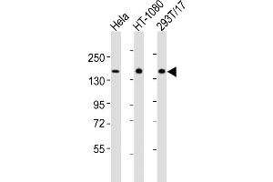Western Blotting (WB) image for anti-Rap Guanine Nucleotide Exchange Factor (GEF) 2 (RAPGEF2) (AA 1464-1498), (C-Term) antibody (ABIN6243297)