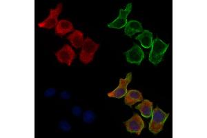 ABIN6260777 and ABIN6277148 staining HepG2 cells by IF/ICC. (Complement Factor H 抗体  (N-Term))