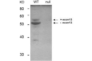 Western Blot of Anti-BIN1 Antibody. (BIN1 抗体)