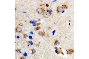 Immunohistochemical analysis of OSGEPL1 staining in rat brain formalin fixed paraffin embedded tissue section.