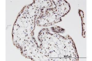 Immunoperoxidase of monoclonal antibody to ZNF397 on formalin-fixed paraffin-embedded human placenta. (ZNF397 抗体  (AA 131-230))