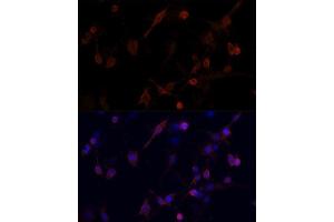 Immunofluorescence (IF) image for anti-Cofilin 1 (CFL1) (AA 1-100) antibody (ABIN6138463)