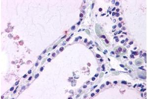 Thyroid, Human: Formalin-Fixed, Paraffin-Embedded (FFPE) (LPCAT1 抗体  (Internal Region))