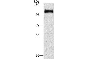 Western blot analysis of Hela cell, using DAB2 Polyclonal Antibody at dilution of 1:350 (DAB2 抗体)
